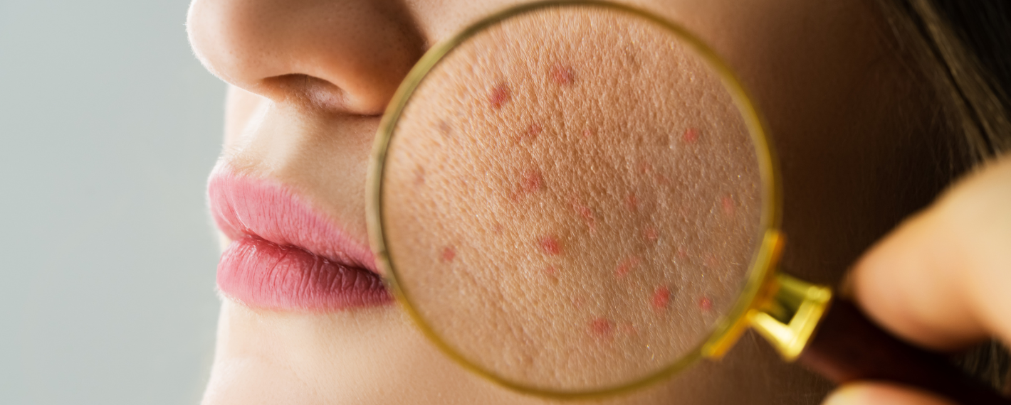 Dermatologia