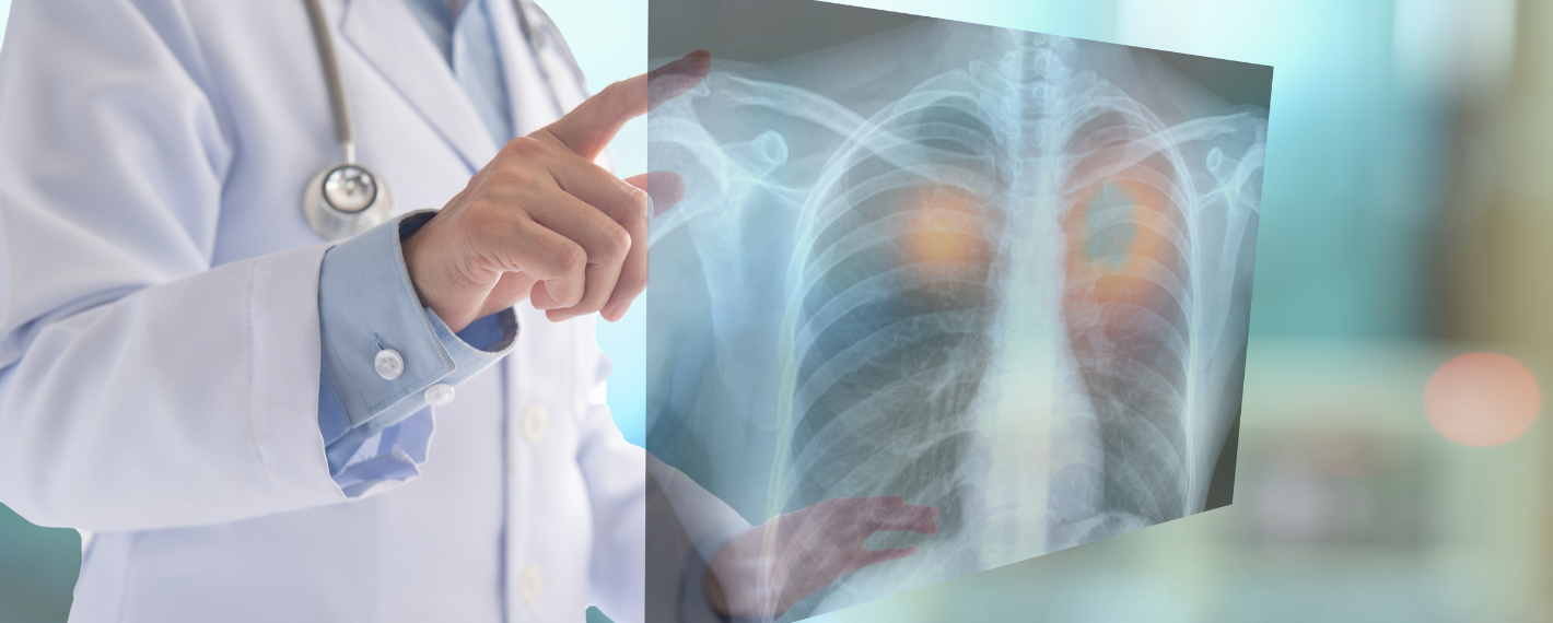 Radiografia